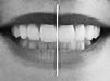Perfect Smile symmetry